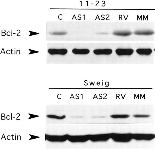 Fig. 1. Effect of Bcl-2 antisense oligodeoxynucleotide treatment on Bcl-2 protein levels in EBV-positive LCLs. Western blot analysis of Bcl-2 expression in two EBV-positive LCLs, 11-23 and Sweig, was performed after exposure to oligodeoxynucleotide for 72 h. C, untreated, cultured in cationic lipid without oligodeoxynucleotide; AS1, Bcl-2 antisense-treated (1.0μ m); AS2, Bcl-2 antisense-treated (0.2μ m); RV, RV oligodeoxynucleotide-treated (0.2μ m); MM, MM oligodeoxynucleotide-treated (0.2μ m). Blots were sequentially exposed to anti-Bcl-2 antibody and anti-actin antibody.