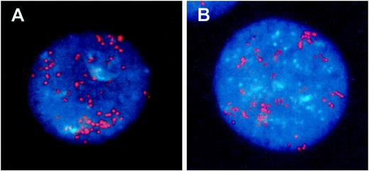 Fig. 1. High-level amplification of TBX2 in(A) KPL-1 and (B) MCF-7 breast cancer cell lines by interphase FISH.