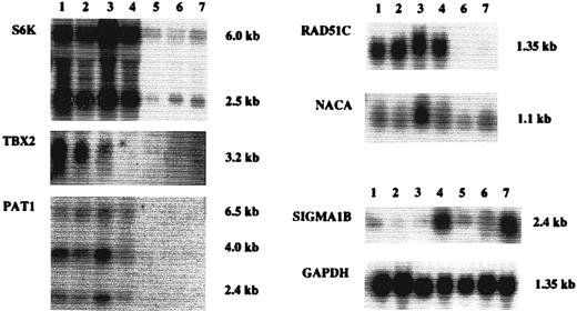 Fig. 2. Expression levels of S6K, TBX2, PAT1, RAD51C, NACA, and SIGMA1B in breast cancer cell lines by Northern analysis. The cell lines analyzed are indicated above the lanes: Lane 1, MCF-7; Lane 2, ZR-75-1wt; Lane 3, KPL-1; Lane 4, BT-474; Lane 5, SUM-52; Lane 6, MDA-436; and Lane 7, HBL-100. The size of each transcript is shown on the left side of the corresponding picture. Hybridization of glyceraldehyde-3-phosphate dehydrogenase probe was used to confirm equal loading among samples.