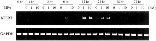 Fig. 1. Activation of hTERT mRNA expression by progesterone. T47-D cells were incubated with or without MPA, and RNA was extracted at various time points. RT-PCR assays were performed to detect hTERT mRNA.