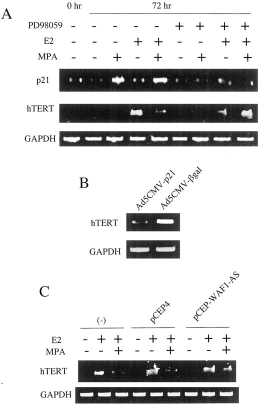 Fig. 5. Involvement of p21 in progesterone-induced repression of hTERT. A, T47-D cells were incubated with MPA and/or E2 at 1 nm in the absence or presence of MEK inhibitor PD98059 at 50 μm. Seventy-two h later, RNA was extracted, and RT-PCR assays were performed to detect p21 and hTERT mRNA. B, T47-D cells were infected with adenoviral expression vectors Ad5CMV-p21 for p21 overexpression or Ad5CMV−β gal as a control. Forty-eight h later, RNA was extracted, and RT-PCR assays were performed to detect hTERT mRNA. C, T47-D cells were transfected with p21 antisense expression vector pCEP-WAF-AS or control empty vector pCEP4. Twenty-four h later, cells were incubated with or without E2 in the absence or presence of MPA at 1 nm for 72 h. RNA was then extracted, and RT-PCR assays were performed to detect hTERT mRNA.
