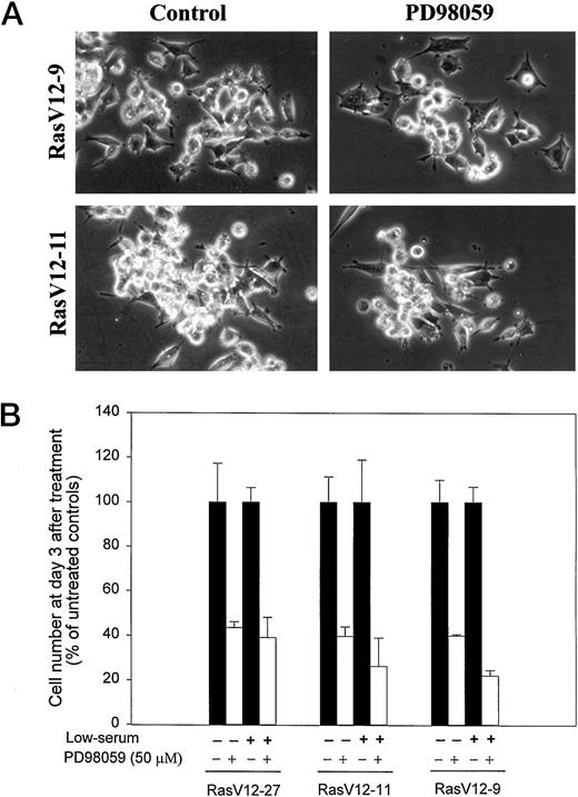 Fig. 4. Effects of PD98059 on morphology and growth of Ras-expressing NCI-H82 cells. A, RasV12-11 and RasV12-9 were treated with PD98059 (50 μm) or vehicle(Control; DMSO, 0.1% final concentration). Cells were monitored for 24–72 h for morphological changes and photographed at 72 h later. B, exponentially growing cells were cultured in either complete medium or a low-serum (0.5% calf serum)medium containing 50 μm PD98059 for 3 days. Controls were cultured in corresponding medium supplemented with vehicle (0.1%DMSO). Cell number was determined by trypan blue exclusion. Results are presented as the ratio of the number of PD98059-treated cells to that of untreated control cells. ×100. Data are the means from two independent experiments performed in triplicate; bars,SD.