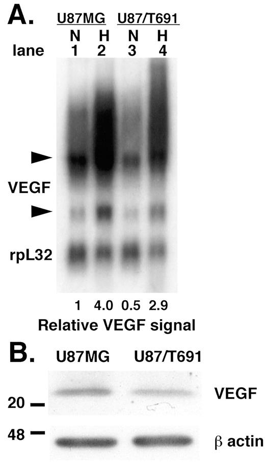 Fig. 1. VEGF mRNA levels in U87 MG and U87/T691 cells. A, cells were subjected to hypoxia (0.2% oxygen; H) or normoxia (21% oxygen; N). After 16 h, RNA was harvested, and then Northern blotting was performed. Ethidium bromide staining of the gel confirmed equal loading of the lanes by visual inspection (data not shown). Northern blot was probed for both VEGF and rpL32, a loading control (see “Materials and Methods”). The numbers shown at the bottom of the figure (relative VEGF signal) represent the ratio of intensity of the lower VEGF band to the rpL32 band. The level in the first lane was arbitrarily designated 1, and the values in the remaining lanes are relative to this. In this particular figure, the upper VEGF bands could not be quantitated because they were overexposed. B, protein lysates from both cell lines were run on a SDS-PAGE gel, and Western blotting was performed as described in “Materials and Methods.”