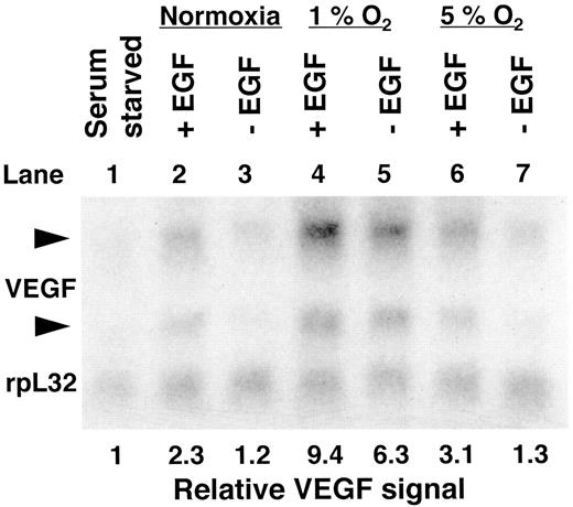 Fig. 2. VEGF mRNA induction in response to EGF and hypoxia in U87 MG cells. U87 MG cells were seeded on day 1. On day 2, the media were removed and replaced with serum-free media. Forty-eight h later, EGF(20 ng/ml) was added to half the dishes but not to the other half. Of the EGF-treated dishes, one-third were subjected to 5% oxygen,one-third were subjected to 1% oxygen, and one-third were kept in normoxia (21% oxygen). The control dishes not treated with EGF were similarly subjected to 5, 1, or 21% oxygen. Nine h later, RNA was harvested, and Northern blotting was performed. Ethidium bromide staining of the gel confirmed equal loading of the lanes by visual inspection (data not shown). The Northern blot was probed for both VEGF and rpL32, a loading control (see “Materials and Methods”). The numbers shown at the bottom of the figure (relative VEGF signal) represent the ratio of intensity of the upper VEGF band to the rpL32 band. The level in the first lane was arbitrarily designated 1, and the values in the remaining lanes are relative to this.