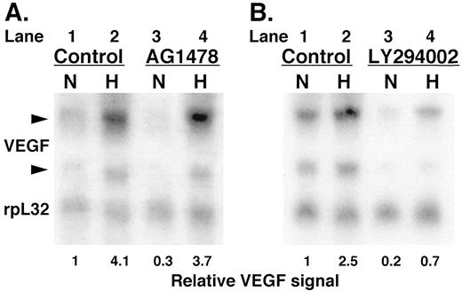 Fig. 8. VEGF mRNA levels after hypoxia in U87 MG cells pretreated with AG1478 or LY294002. U87 MG cells were treated with DMSO (control)or LY294002 (20 μm) for 2 h prior to exposure to normoxia (N) or hypoxia (0.2% oxygen; H)for 6 h. Samples were harvested for RNA at the end of the experiment, which was run on an agarose/formaldehyde gel. Ethidium bromide staining of the gel was performed, which confirmed equal loading of the lanes by visual inspection (data not shown). The gel was transferred to a Northern blot that was probed for VEGF and rpL32. The numbers shown at the bottom of the figure (relative VEGF signal) represent the ratio of intensity of the upper VEGF band to the rpL32 band. The level in the first lane was arbitrarily designated 1, and the values in the remaining lanes are relative to this.