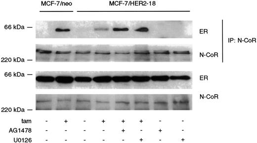 Fig. 5. Inhibition of HER2 or MAPK enhances tamoxifen-induced association of ER with N-CoR. MCF-7/neo and MCF-7/HER2–18 cell lysates were prepared from monolayers that had been treated or not with 1μ m 4-OH tamoxifen (tam) for 4 h. Cell lysates were tested for ER and N-CoR content by immunoblot analysis. To document the association of ER with N-CoR, in some cases N-CoR was first immunoprecipitated (IP), and immune complexes were subjected to ER or N-CoR immunoblot procedures (top two rows). Where indicated, MCF-7/HER2–18 cells were treated for 24 h with 10 μm AG1478 or 3 μm U0126 either alone or with 1 μm 4-OH tamoxifen for the last 4 h of the 24-h period. Data shown are representative of three independent experiments.