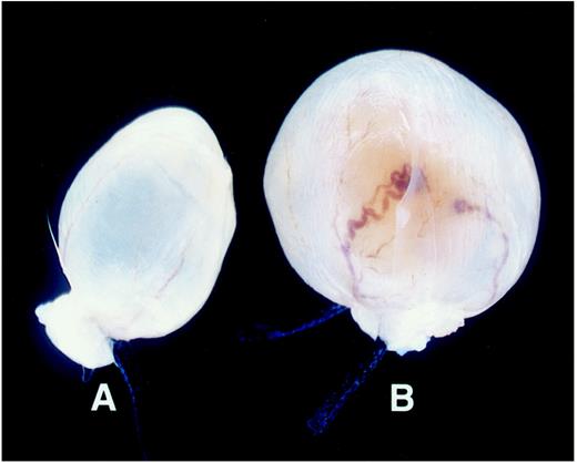 Fig. 2. Celecoxib inhibits urinary bladder cancer growth in the OH-BBN-treated mouse. All bladders were excised, inflated with 10%buffered formalin, and observed under high-intensity light for gross lesions. Pictured are representative urinary bladders from celecoxib-(A) and vehicle- (B) treated animals 8 months after initiation of OH-BBN treatment.