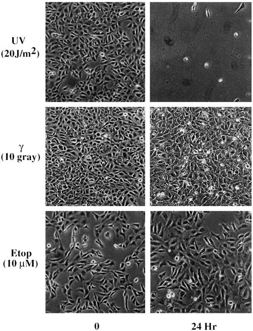 Fig. 1. Morphology of F9 cells after irradiation. F9 cells (50%confluent) were exposed to UV (20 J/m2), γ-ray (10 Gy),or 10 μm etoposide, as indicated. Cells were examined and photographed under light microscope at the 4 × 25 zoom 24 h after irradiation. The exact same phenotype was also observed with Tera2 cells.
