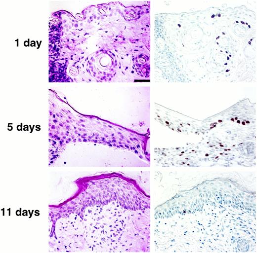 Fig. 3. Histopathology and proliferation during wound healing. On day 1 after wounding, there is a slight increase in epidermal thickness at the wound edge and increase in keratinocyte BrdUrd incorporation,particularly in the hair follicle ORS. During reepithelialization,BrdUrd-positive cells are localized to the basal and immediate suprabasal keratinocytes, comprising the sheet of migrating keratinocytes covering the open wound. By day 11, reepithelialization is complete, residual epidermal thickening remains in the wound center,and contracture narrows the total wound area. Similar to normal skin,rare BrdUrd-positive cells are evident in the basal layer. Bar (all panels), 50 μm.