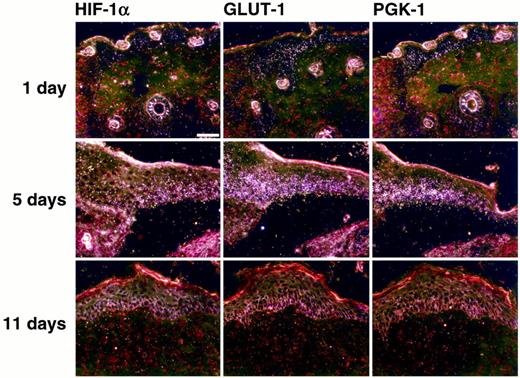 Fig. 4. Spatio-temporal increase and decrease in HIF-1α, GLUT-1,and PGK-1 mRNA during wound healing. HIF-1α, GLUT-1, and PGK-1 mRNAs are just detectable in basal and suprabasal keratinocytes on day 1 after wounding. During wound reepithelialization, hybridization signals for mRNAs of all three genes increase particularly in the basal layer of the keratinocyte sheet covering the open wound. After completion of reepithelialization, mRNA of each of these genes is almost undetectable. Bar (all panels, 50μm).