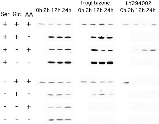Fig. 4. Phosphorylation of Akt and the effects of troglitazone and LY294002 on Akt phosphorylation in PANC-1 cells. Cell lysates were removed at 2, 12, and 24 h after nutrient deprivation. A 20-μg sample of the cell lysates was loaded into each well for fractionation by 12% SDS-PAGE. Phosphorylation of Akt was investigated using Western blot analysis with phospho-specific (Ser-473) Akt antibody (New England BioLabs).