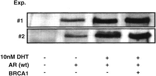 Fig. 2. AR protein expression is not stabilized by BRCA1 in transfected cells. PC-3 cells were cotransfected with 50 ng of pCMV-AR and 250 ng of pcDNA-BRCA1 as indicated. Forty-eight h after transfection, whole-cell extracts were prepared, and equivalent amounts of each extract were probed with anti-AR antibody. Autoradiograms from two independent experiments are presented. Radiographic bands were analyzed by scanning densitometry using a Bio-Rad Model GS-710 imaging densitometer. No significant increase in AR band density was observed in the presence of BRCA1 (data not shown).
