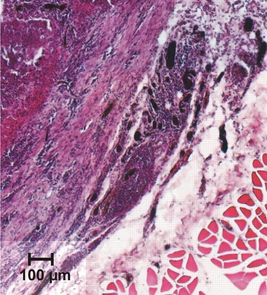 Fig. 15. Section C from Fig. 12<$REFLINK>. Transitional region between musculature and tumor tissue. Black condensations, FFs within and outside the tumor.