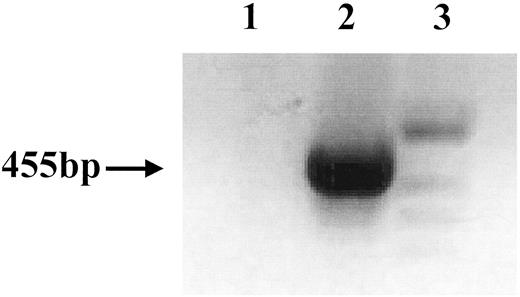 Fig. 3. PCR analysis confirms the presence of the PyV MidT transgene in MidT2-1 cells. Lane 1, R/F6–10 wap-H-ras transgenic mouse mammary tumor cell line. Lane 2, MidT2-1 MMTV-PyV MidT transgenic mouse mammary tumor cell line. Lane 3, molecular weight marker.