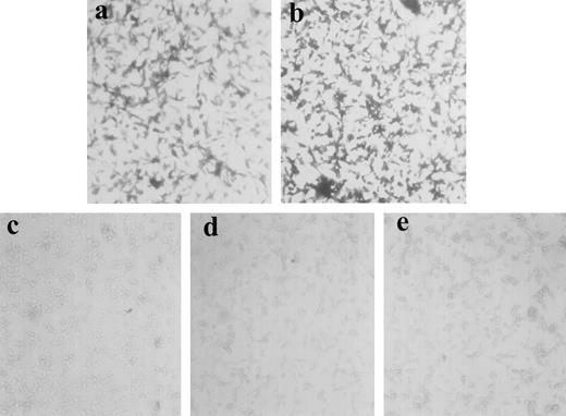 Fig. 2. Loss of β-galactosidase expression in tumor cells isolated from animals treated with transfectant influenza A viruses. Tumor cells isolated from the lungs of untreated (b) or of BHAGAL (c)-, NAGAL (d)-, and MINIGAL(e)-treated animals were stained with X-gal to determine their levels of β-galactosidase expression. X-gal staining of CT26.CL25 tumor cells prior to inoculation into animals is also shown(a).