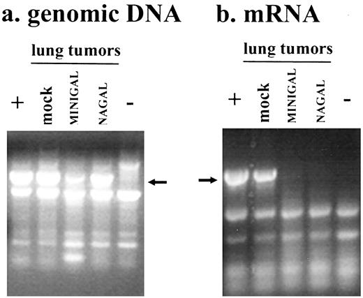Fig. 3. Determination of the presence ofβ-galactosidase-specific sequences in tumor cells isolated from animals. Genomic DNA (a) or total mRNA(b) was isolated from tumor cells derived from lung metastases of mock-treated animals or of MINIGAL-treated and NAGAL-treated animals. A PCR or a reverse transcription-PCR was performed using these samples and nucleotide primers specific for theβ-galactosidase open reading frame. Samples derived from CT26.CL25 and from CT26 cells prior to inoculation into animals were included in the assays as positive and negative controls, respectively.