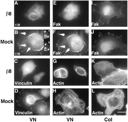 Fig. 4. Ligation of αvβ8 inhibits the focal contact localization of αvβ5 and FAK in H647 cells. The β8-expressing H647 cells, when plated on VN, displayed almost no localization of αv(A), vinculin (C), or FAK in focal contacts (E). In contrast, in mock-infected H647 cells plated on VN, αv (B and inset b)codistributed with β5 (B and inset a)and FAK (F). On VN, the mock-infected cells formed vinculin-containing focal contacts (D), had rope-like actin fibers at the cell periphery in addition to fully developed actin stress fibers (H), whereas the β8-expressing lung carcinoma cells formed rope-like actin fibers at the cell periphery and had few recognizable internal stress fibers (G). No differences in focal contact formation, as determined by FAK(I and J) or vinculin localization (not shown), were seen between mock-infected and β8-expressing H647 cells plated on Col I (K and L). Note that the nuclear staining seen with the αv, FAK, and vinculin antibodies is most likely nonspecific and was seen equally in both mock andβ8-expressing cells. Shown is a representative experiment(n = 4). Bar, 25 μm.