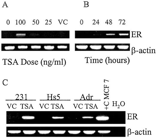 Fig. 1. Upper panels: A, dose response of TSA on ER transcription in MDA-MB-231 cells analyzed by RT-PCR. B,time course of TSA (100 ng/ml) on re-expression of ER mRNA for 48 h in MDA-MB-231 cells. C, RT-PCR analysis of ER mRNA re-expression by TSA for 48 h in a panel of known ER-negative breast cancer cell lines. The ER-positive prototype, MCF-7, was used as a RT-PCR-positive control. Lower panels: β-actin RT-PCR product provides a control for the amount of intact RNA used in the reactions. VC, vehicle-treated; 231,MDA-MB-231; Hs5, Hs578t; Adr,MCF-7/Adr.