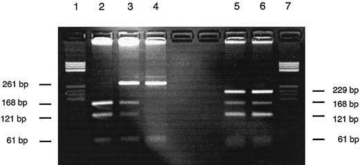 Fig. 1. 3% 3:1 NuSieve-agarose gel electrophoresis of MPO-DNA fragments stained with ethidium bromide. Fragment lengths are given in bp. Lanes 1 and 7, DNA size standard; Lanes 2–4, AciI digestion of homozygous wild-type (−463G/G),heterozygous mutant (−463G/A), and homozygous mutant (−463A/A); Lanes 5 and 6, partial loss of the constitutive AciI GCGG restriction site detected in two laryngeal cancer patients due to heterozygous G/A mutations at positions −297 and −296 nt (see Fig. 2<$REFLINK>).