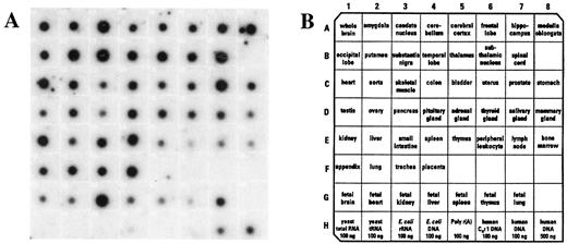 Fig. 3. Drg-1 expression in normal human tissues. A human RNA master blot from Clontech was probed with a 32P-labeled Drg-1 probe. A,Drg-1 expression pattern in normal human tissues. B, RNA samples included on the blot.