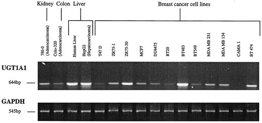 Fig. 2. Ethidium bromide-stained agarose gel of UGT1A1 and GAPDH RT-PCR products.