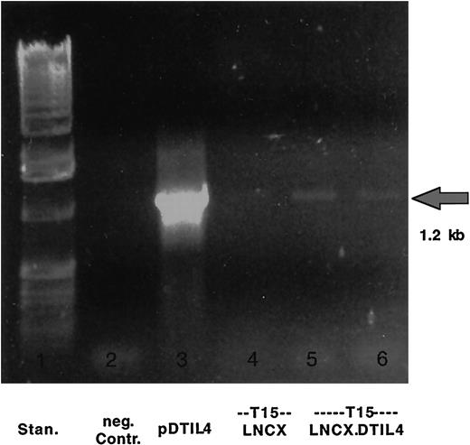 Fig. 8. Detection of DT390 gene fragment in neo-selected T15 cells. Genomic PCR assay detected the presence of the 1.2-kb DT390 gene in T15 cells selected for 2 weeks in G418. Lane 1 is the size standards. Lane 2 is a negative control. Lane 3 shows the pDTIL4 plasmid as a positive control. Lane 4 shows T15 transduced with empty LNCX vector (no target gene)as a negative control. Lanes 5 and 6 show samples of the selected T15 cells that were originally transduced with sigIL4DT390/LNCX virus. These lanes reveal the presence of the 1.2-kb fragment.