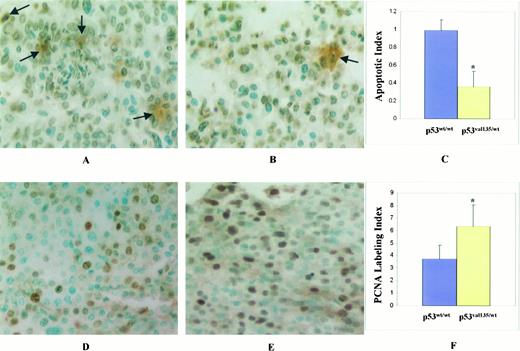 Fig. 2. Level of apoptosis and PCNA immunostaining in mouse lung tumors from (UL53–3 × A/J)F1 mice after treatment with NNK. A, the level of apoptosis in NNK-induced mouse lung tumors from p53wt/wt mice (×400); B, the level of apoptosis in lung tumors from p53 mut mice treated with NNK (×400); C,a comparison of AIs in lung tumors from p53wt/wt mice and p53val135/wt mice; D, the PCNA immunostaining in lung tumors from p53wt/wt mice (×400); E, the PCNA immunostaining in lung tumors from p53val135/wt mice (×400); F, a comparison of PCNA labeling indices in lung tumors from p53wt/wt mice and p53val135/wt mice. P < 0.05, statistically significant: Arrow,apoptotic cells.
