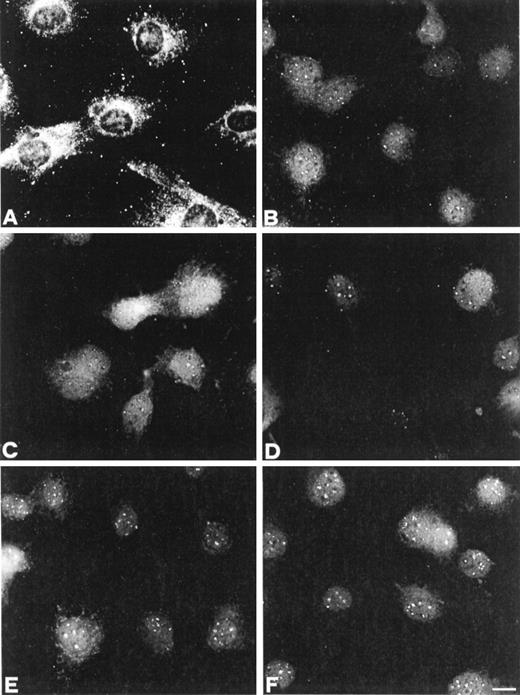 Fig. 2. Immunocytochemical staining with a polyclonal antibody showing the subcellular distribution of PKC-α in Swiss 3T3 cells. A, quiescent cells. B, 30-min IGF-I stimulation. C, 60-min IGF-I stimulation. D, 90-min IGF-I stimulation. E, 120-min IGF-I stimulation. F, 180-min IGF-I stimulation. Bar, 10 μm.