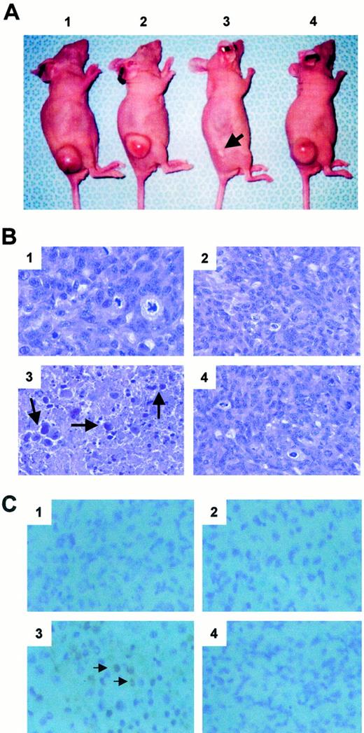 Fig. 4. Induction of apoptosis by Ad/GT-Bak + Ad/GV16 in H1299 tumors. A, H1299 s.c. tumors in the right flank of athymic nude mice after treatment with PBS (1),Ad/GT-Bak + Ad/GFP (2), Ad/GT-Bak + Ad/GV16 (3), and Ad/GT-LacZ + Ad/GV16(4). Arrow, the location of the Ad/GT-Bak-injected tumor. B, histology of H1299 tumors 12 h after treatment with PBS (1), Ad/GT-Bak + Ad/GFP (2), Ad/GT-Bak + Ad/GV16(3), and Ad/GT-LacZ + Ad/GV16(4; H&E staining, ×40 magnification). Condensed cells(arrows), a morphological sign of apoptosis, were seen in tumors of mice treated with Ad/GT-Bak + Ad/GV16 but not in tumors of mice treated with PBS or control vectors. C,TUNEL analysis of H1299 tumors 12 h after treatment with PBS(1), Ad/GT-Bak + Ad/GFP (2),Ad/GT-Bak + Ad/GV16 (3), and Ad/GT-LacZ + Ad/GV16 (4). TUNEL-positive cells(arrows) were seen only in tumors of mice treated with Ad/GT-Bak + Ad/GV16.