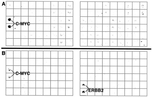 Fig. 2. Two examples of the genomic hybridization on cDNA arrays. A, high-level amplification of MYC in colon cancer cell line Colo320. Signal intensity of MYCis 16-fold higher than the nonamplified signal intensity in this hybridization. B, hybridization of breast cancer cell line SKBR3. In this hybridization, the signal intensity ratios were 9-fold for MYC and 22-fold for ERBB2. The level of ERBB2 amplification has been determined to be 6-fold and MYC amplification 32-fold by interphase FISH.4 The grid indicates the pattern of cDNAs printed on the microarray.