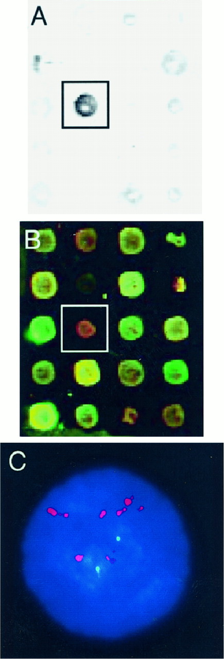 Fig. 3. Amplification and overexpression of zinc finger gene ZNF133 in NGP neuroblastoma cell line. A,section of a 1400-element cDNA microarray containing ZNF133 (boxed) after hybridization of NGP total genomic DNA and tyramide detection. The intense ZNF133 signal (8-fold) suggests amplification of ZNF133. B, corresponding section of an identical microarray after cDNA hybridization with NGP cDNA(pseudocolor red) and normal fibroblast DNA(pseudocolor green). The red:green ratio of 3.37 for ZNF133 (boxed) shows that the amplified copies of ZNF133 are highly overexpressed. C,interphase FISH on NGP confirming amplification of ZNF133 (red) relative to a chromosome 20α satellite (green).