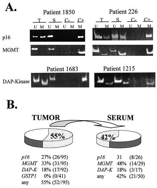 Fig. 1. Gene promoter hypermethylation in primary tumors and serum from HNSCC patients. A, representative examples of MSP of p16, MGMT, and DAP-kinase in tumor(T) and serum (S) including water as a negative control (C−) and a positive methylated control(C+). Lanes U and Mcorrespond to the unmethylated and methylated reactions, respectively. B, percentages of patients with epigenetic alterations in the primary tumor and serum. DAP-K, DAP-kinase.