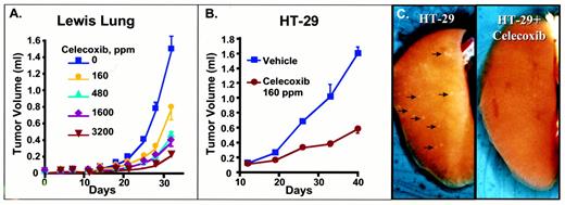 Fig. 3. Inhibition of tumor growth and lung metastasis by celecoxib in mice. A, Lewis Lung carcinoma (106cells) was implanted into the hind paws of C57/B16 male mice to develop tumors. Groups of 20 animals were treated with doses of celecoxib(160,480,1600, and 3200 ppm) in their food from the day of implant until the end of the study, and tumor volume was determined biweekly using a plethysmometer. The data are expressed as the mean +/− SEM. Student’s and Mann-Whitney tests were used to assess differences between means using the InStat software. B, HT-29 human colon carcinoma cells were also implanted in the hind paws(106 cells) of nude mice. Celecoxib therapy was initiated when tumors reached a mean volume of 100 mm3 and maintained for the duration of the experiment. C, lung with several metastatic nodules (arrows) from a HT-29-implanted mouse. D, a lung without metastases from a mouse bearing HT-29 tumor treated with 1600 ppm celecoxib (Table 1)<$REFLINK>.