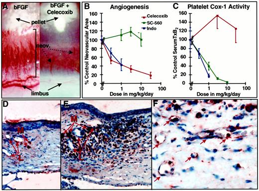 Fig. 4. Celecoxib is a potent inhibitor of angiogenesis. A, a representative photograph of neovascularization induced by basic FGF-2 in the rat cornea (left) and its inhibition by celecoxib (right). B,pharmacological inhibition of angiogenesis by COX inhibitors. The COX-2 inhibitor celecoxib, the COX-1-specific inhibitor SC-560, and the nonspecific COX inhibitor indomethacin were dosed p.o. b.i.d.(n = 6 per dose) for 5 days. Celecoxib and indomethacin inhibited angiogenesis (P < 0.001, Students t test) at all doses tested,whereas SC-560 had no effect. C, representation of COX-1 activity in vivo. Sera from the same rats were immunoassayed (Cayman Chemical) for TxB2, a product of platelet COX-1 activity. While potently inhibiting angiogenesis,celecoxib had no effect on platelet COX-1 activity. SC-560 did not affect angiogenesis at 3 and 10 mg/kg/day, doses that clearly inhibited COX-1 by 68% and 86%, respectively. Because indomethacin inhibits both isozymes, at doses that suppressed angiogenesis, it inhibited platelet COX-1, as well. These experiments were repeated at least three times with six rats per group. D, COX-2 expression(red) and immunohistological examination of a transverse section of the temporal limbic region of the rat cornea 4 days after implant with a placebo pellet. The eyes were resected, fixed in 10%formalin, and stained for COX-2 using specific antiserum. The photograph shows the presence of COX-2-positive macrophages(M) near the limbic vessels (L). No evidence of inflammation or neovascularization was observed in placebo corneas. E, an identical region of the FGF-2-implanted cornea showed an expanded stroma filled with an influx of COX-2-positive cells, including macrophages (M),fibroblasts, and endothelial cells. Mature endothelial cells present in the established limbic vessels (L) did not express COX-2. F, high-power photomicrograph of a section of corneal stroma showed the presence of newly developed angiogenic blood vessels(arrows) with some luminal RBCs. The endothelium of these vessels expressed the inducible COX-2 enzyme.