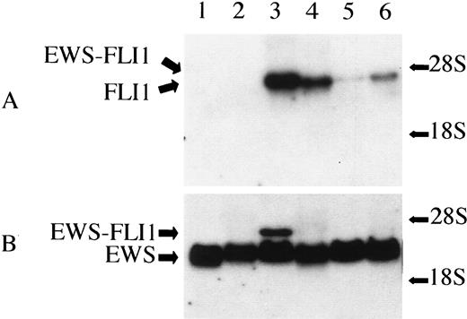Fig. 2. Absence of EWS-FLI1 RNA in HEK293 and EcR293 cells on the Northern blot. Lanes 1 and 2, two neuroblastoma cell lines, STA-NB-1.1 and LAN1; Lane 3,the EFT cell line SK-N-MC; Lane 4, the ALL cell line MOLT, which is known to express germ-line FLI1; and Lanes 5 and 6, EcR293 and HEK293. The blot was probed separately with the 3′ FLI1 portion (A) and with the 5′EWS portion of type 1 EWS-FLI1 cDNA (B).