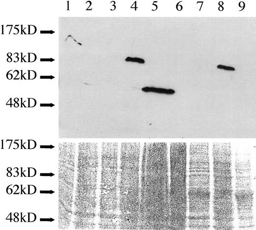 Fig. 3. Absence of FLI1 and EWS-FLI1 protein in Ad5-transformed cells on the Western blot. Lanes 1–9, EFT cell line STA-ET-2.2 (EWS exon 9/FLI1 exon 4 fusion), HEK293, EcR293, EFT cell line IARC-EW2 (EWS exon 7/FLI exon 5 fusion), ALL cell line MOLT(expressing germ-line FLI1), neuroblastoma cell line Vi856, HER911, EFT cell line VH64 (EWS exon 7/FLI1 exon 5 fusion), and HER-RIC.c4. The lower panel of the figure presents Ponceau S staining of the Western blot as a loading control.
