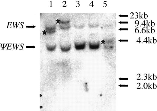 Fig. 4. No evidence for an EWS gene rearrangement in HEK293 cells is shown on the genomic Southern blot. EcoRI-digested genomic DNA was probed with an EWS exon 7 containing genomic probe detecting germ-line EWS (EWS)and an EWS pseudogene (ΨEWS). Bands resulting from an EWS gene rearrangement are indicated by stars. Lanes 1, 2, and 5, EFT cell lines A673, SK-N-MC, and STA-ET-1,respectively; Lanes 3 and 4, the Ad5-E1-transformed cell line HEK293 reported by Sanchez-Prieto(8) to carry a type I gene rearrangement and a derivative cell line EcR293, respectively.