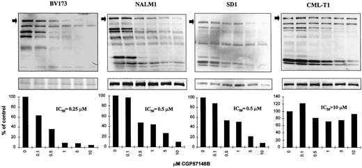 Fig. 1. Top panels, tyrosine phosphorylation of BCR-ABL (arrow) at graded concentrations of STI571. Middle panels, To control for equal protein loading, the blots were stripped and reprobed with an anti-ABL antibody or stained with Coomassie Blue. Bottom panels, densitometric analysis of the BCR-ABL phosphotyrosine bands, and IC50. Analogous experiments were performed in TOM1 and ALL/MIK cells (Table 3)<$REFLINK>. Attempts to quantify the phosphorylation of P180BCR-ABLin MY cells were not successful.