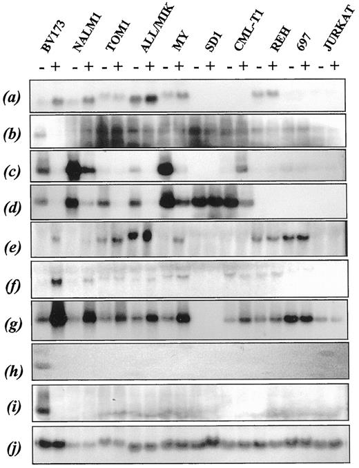 Fig. 6. Northern blot analysis of lymphoid cell lines treated with 1 μm STI571 for 24 h. The blots were probed with(a) MPP1, (b) CSCP, (c)integrin α6, (d) cyclin D2,(e) BCL-6, (f) DDI, (g)DD221, (h) DDQ, (i) OSMRβ, and(j) β-actin (control).