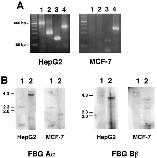 Fig. 4. RT-PCR analysis of FBG mRNAs and Southern analysis of genomic DNA from MCF-7 cells. Total RNA was reverse transcribed and amplified by PCR. The amplified products were resolved by electrophoresis in TAE (Tris-acetate/EDTA) buffer on 1.8%agarose gels. The amplified products and expected size are shown in A: Lanes 1, Aα, 634 bp; Lanes 2, Bβ, 300 bp; Lanes 3, γ, 182 bp; and Lanes 4, β-actin, 450 bp. Left,molecular size markers in 100-bp increments. B, genomic DNA from HepG2 and MCF-7 cells was digested with EcoRI(Lanes 1) and HindIII (Lanes 2) and analyzed by Southern hybridization using 32P-labeled cDNA probes for FBG Aα and Bβ chains. Left, molecular size markers in kb.
