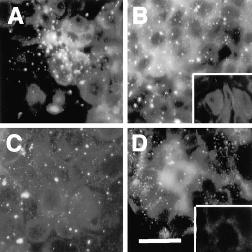 Fig. 5. Indirect immunofluorescent staining of endogenous FBG. MCF-7 cells were grown on glass coverslips for 14 days. The cells were washed extensively, fixed, and stained with anti-FBG pAb or FBG-specific mAb, followed by rhodamine-conjugated goat antirabbit or goat antimouse secondary antibodies, respectively. A,α-RGD; B, 18C6; C, J88B; D, anti-FBG pAb. Inset in B, staining with rabbit antimouse polyvalent immunoglobulin alone. Inset in D,staining with goat antirabbit IgG alone; bar, 25 μm.