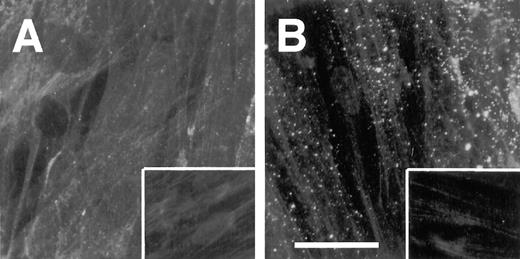 Fig. 7. Conditioned MCF-7 medium overlay onto HFF cells. HFF cells were grown on glass coverslips for 14 days to establish a mature ECM. The cells were washed, and MCF-7 conditioned medium was overlaid onto HFF cells and incubated for an additional 3 days. The cells were stained under nonpermeabilized conditions with pAb anti-FBG antibodies,followed by rhodamine conjugated-goat antirabbit secondary antibodies and visualized by fluorescence microscopy. A, HFF cells stained with anti-FBG pAb only. B, HFF cells with MCF-7 conditioned medium overlay and stained with anti-FBG pAb. Insets, secondary antibody staining only; bar, 15 μm.