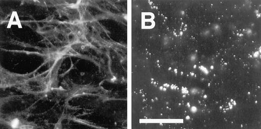 Fig. 8. Assembly of plasma FBG into ECM of HFF and MCF-7 cells. HFF (A) and MCF-7 (B) cells were grown on glass coverslips for 10 days. Purified plasma FBG labeled with Oregon Green was added to cells and incubated for 24 h. The cells were washed extensively, fixed, mounted, and directly visualized for Oregon Green-FBG by epifluorescence microscopy. Bar in B, 15 μm.