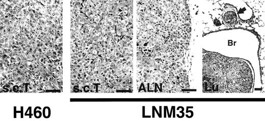 Fig. 1. Histological examination of the s.c.T.s and metastases to an ALN and lung (Lu) of mice s.c. injected with parental NCI-H460 or LNM35 cells. Both LNM35 and NCI-H460 show the typical histological features of large cell undifferentiated carcinoma of the lung. Note that infiltration of LNM35 cells is evident in a peribronchial LV (arrow). Bars, 50 μm.