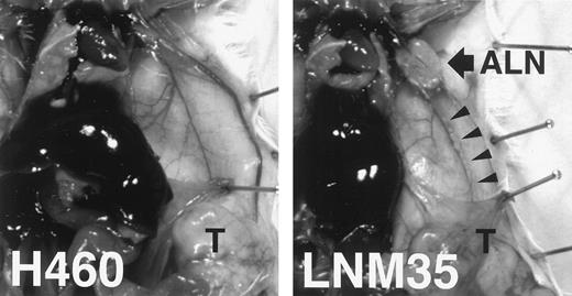 Fig. 2. Representative photograph of lymphogenous metastasis in an LNM35-bearing mouse. An enlarged LV (arrowheads) and an ALN swelling (arrow) are seen in the s.c.T.-bearing mouse with LNM35 but not in the parental line, NCI-H460. Histological examination disclosed lymphogenous metastases in the cases of LNM35-bearing mice.