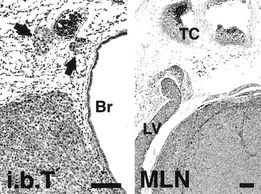 Fig. 3. Histological examination of orthotopically propagated LNM35 in the lung (i.b.T.) and metastasis to the MLNs. The intravasation of LNM35 cells is evident in the peribronchial LVs (i.b.T., arrows) and in an afferent LV of the MLN. Br, bronchus; Tc, tracheal cartilage. Bars, 100 μm.