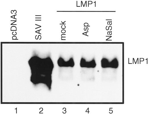 Fig. 2. Immunoblots for LMP1. Lysates were harvested after mock treatment or treatment with either 5 mm aspirin(Asp) or 10 mm sodium salicylate(NaSal) for 24 h. Fifty μg protein of each sample except for SAV III (20 μg) were loaded on a 10% polyacrylamide gel. SAV III is an EBV-positive Burkitt’s lymphoma line exhibiting type III latency.