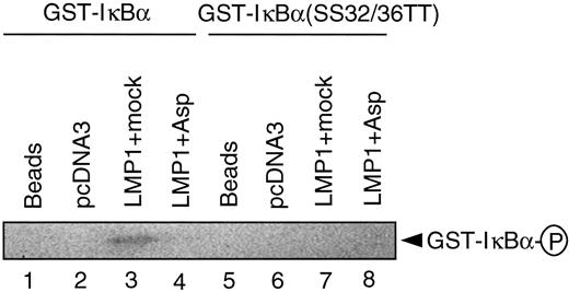 Fig. 8. In vitro kinase assay of IKK. Whole-cell extracts of vector-transfected and LMP1-transfected C33A cells with or without treatment with 5 mm aspirin were subjected to in vitro kinase assays using GST-IκBα or GST-IκBα(SS32/36TT) for the substrate as indicated. Arrow, 32P-phosphorylated GST-IκBα(circled P).