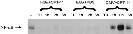 Fig. 3. A, EMSA of nuclear protein extracts from LOVO tumors after treatment with the super-repressor IκBα and CPT-11 was used to evaluate the ability of Ad.CMV.IκBα to inhibit NF-κB activation in vivo. Tumors were treated with a single intratumoral injection of Ad.CMV.IκBα (labeled IκBαabove) or control vector Ad.CMV3 (labeled CMV above) as described in“Materials and Methods.” Tumors were treated with CPT-11 24 h after adenovirus injection and harvested at time 0 (24 h after virus treatment), 1, 2, and 6 h after drug treatment. The positive control for this experiment was obtained from the colorectal cell line WiDr treated with SN38 at 2 h.