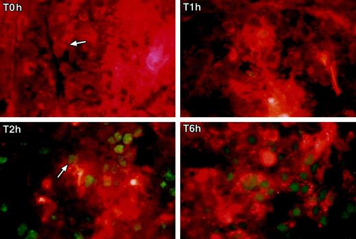 Fig. 4. Two-color immunohistochemical staining of tumor sections was performed to evaluate adenovirus-mediated transfer of the super-repressor IκBα gene into tumor cells and the level of apoptosis induced by combined treatment of tumors with the super-repressor IκBα and CPT-11. Tumor cells expressing the HA-tagged super-repressor IκBα (fluorescent red) and cells staining TUNEL positive (fluorescent green, see arrows) were detected using a two-color fluorescent microscope (×100) at times 0 (T0h), 1(T1h), 2 (T2h), and 6(T6h) h after CPT-11 treatment.
